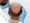 Doctor examines a bald man's scalp for Hair Restoration System Birmingham treatment.