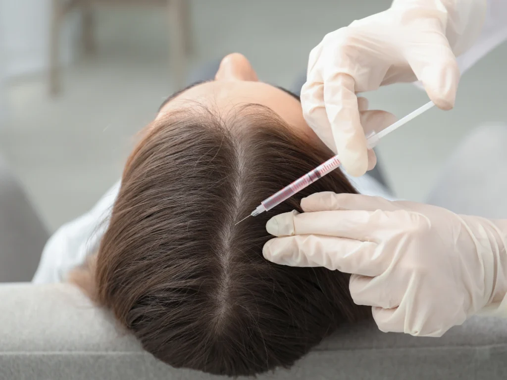 Hair loss treatment with mesotherapy for an older woman at Birmingham's top clinics.