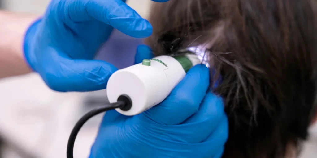 Scalp examination using a digital device during Hair Regrowth Treatment in Birmingham.
