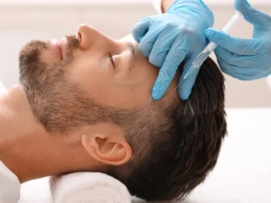 Scalp injection treatment at the Best Hair Loss Clinic in Birmingham for hair restoration solutions.