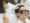Laser therapy session for Hair Regrowth Treatment in Birmingham with protective eyewear.
