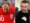 Before and after Hair Transplant Famous Actors UK with improved hairline and fuller look.