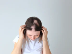 Woman examining thinning hair on crown, considering hair transplant for women treatment options