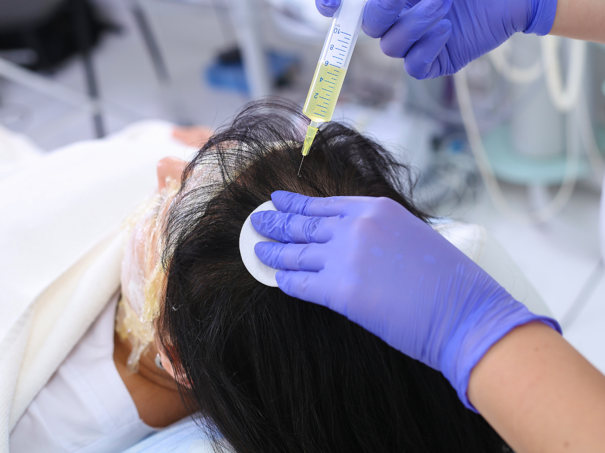 PRP Hair Restoration Before and After procedure showing platelet-rich plasma injection on scalp.