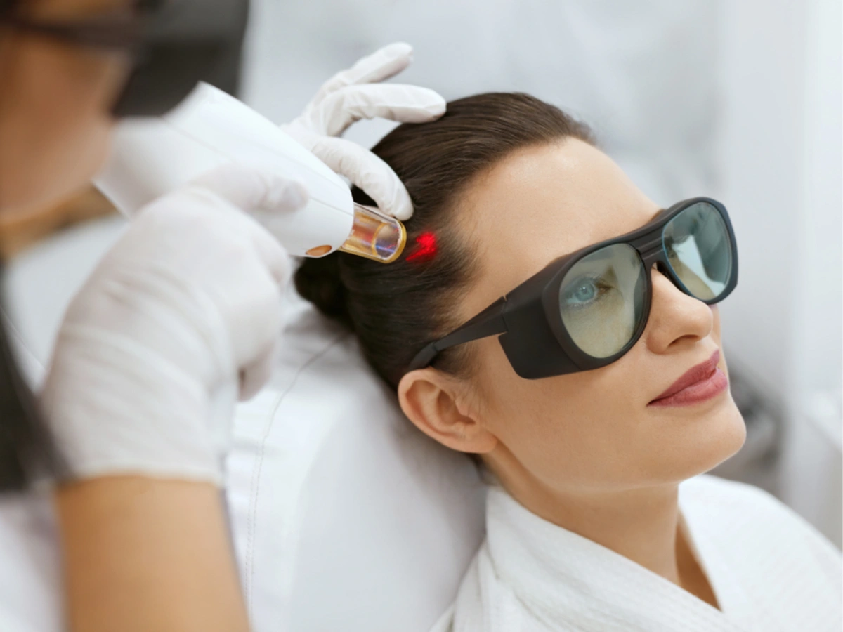 Hair Regrowth Treatment session on hairline with protective eyewear, showcasing modern cosmetic laser technology.