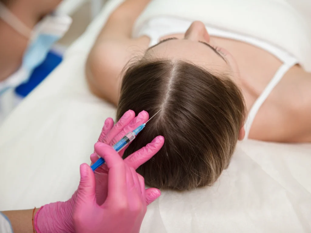 Close-up of Exosome Therapy Birmingham procedure targeting thinning hair with medical scalp injections