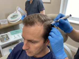 Exosome Therapy vs. Hair Transplants procedure comparison showing surgical transplant and non-surgical scalp therapy