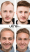 Before and after results of hair system for men in Birmingham showing natural hair restoration and improved appearance.